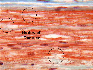 Nodes of Ranvier - Hardcore for Everyone | Ultimate Metal - Heavy Metal