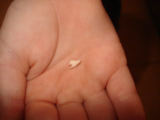 first lost tooth