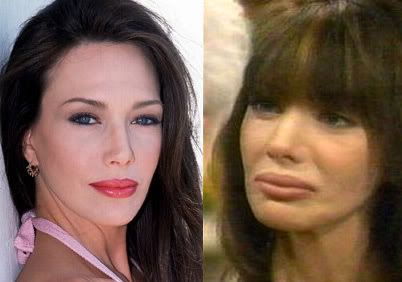 Hunter Tylo Plastic Surgery on Lisa Rinna   I Look Like A Freak  After Too Much Plastic Surgery