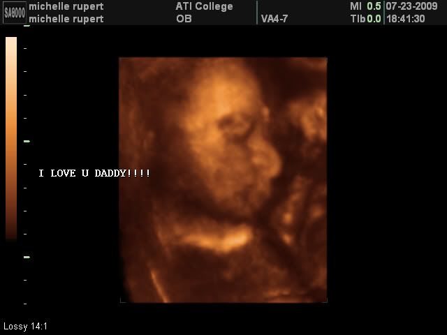 3d ultrasound pictures at 20 weeks. 3D-Ultrasound-8-Weeks; 20 Week