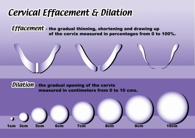 effacement-babycenter