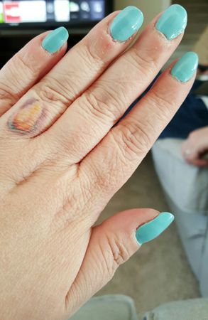 image of my hand showing off robin's egg blue nail polish