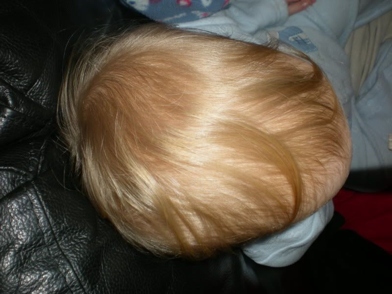 Flat head syndrome BabyCentre