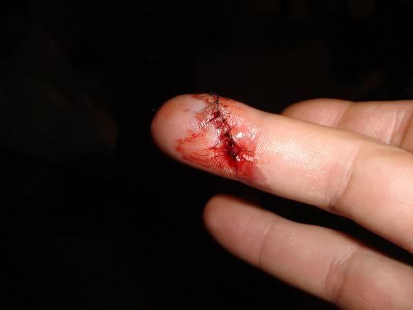 cutfinger.jpg