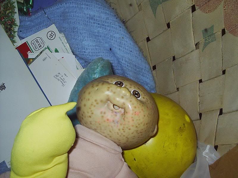 acne baby (found in lenards upstairs) Pictures, Images and Photos