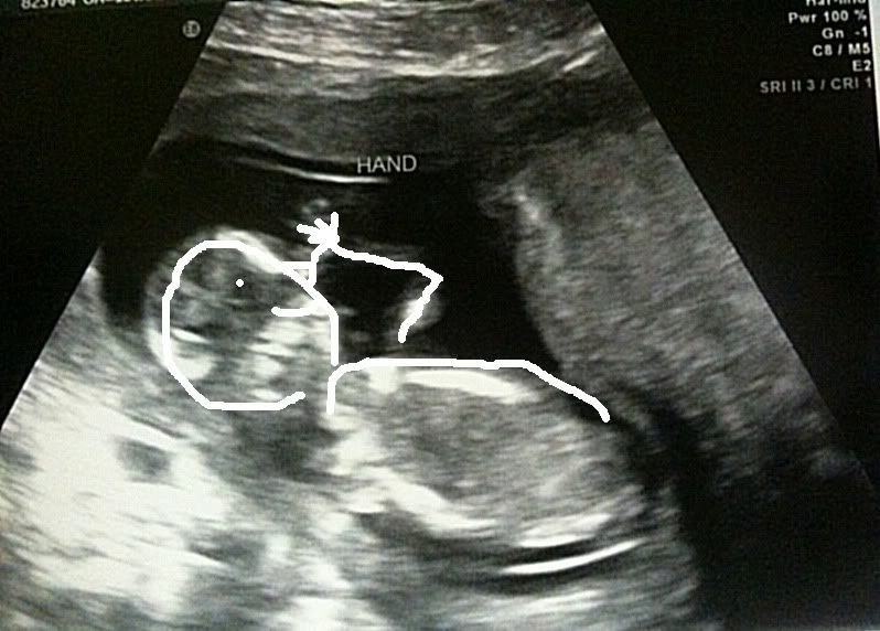 Black Baby Ultrasound