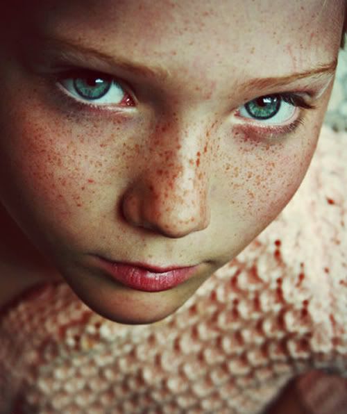 freckle1.jpg Photo by galexiegirl | Photobucket