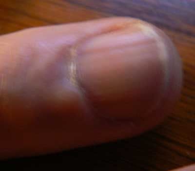 Finger.jpg