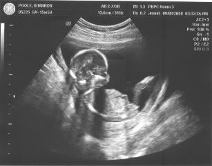 sonogram 16 wk