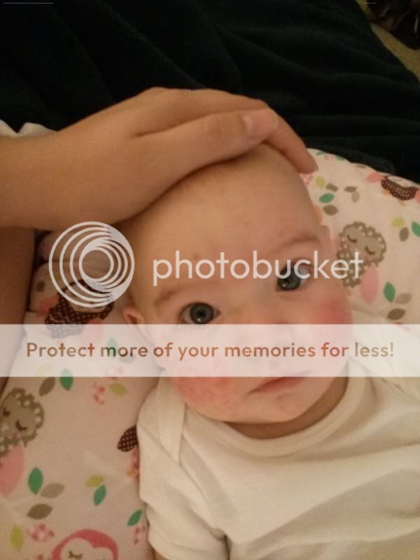Roseola? Fifths? *pics* BabyCenter