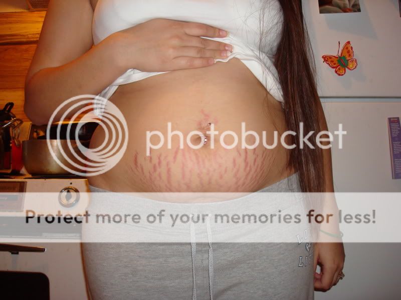 Postpartum Belly Pics Page 6 BabyCenter