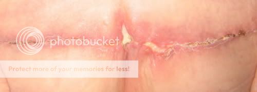 On Plastics (Pics Included)... wls — LiveJournal