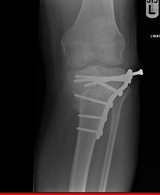 What's your x-ray picture look like?