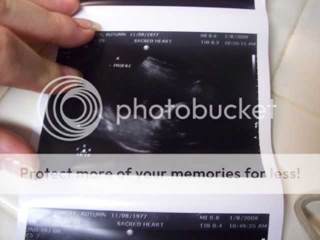 Ultrasound Pictures US6