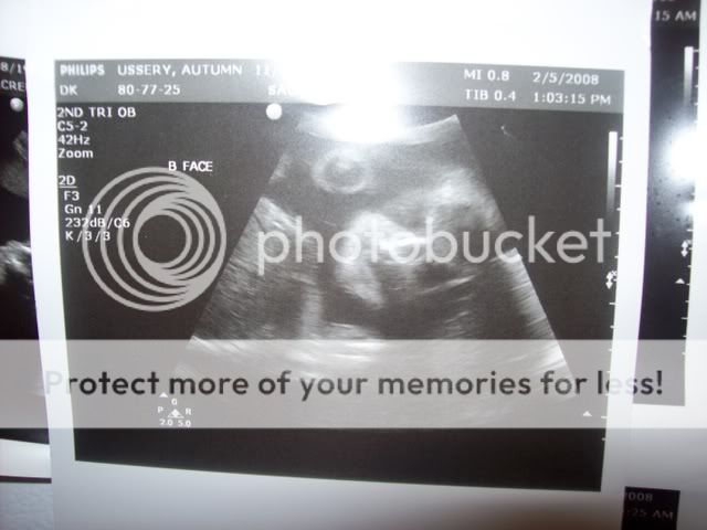 Ultrasound Pictures Babyb
