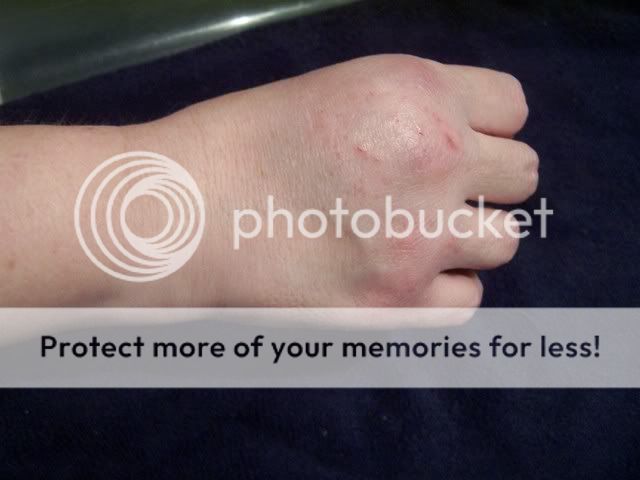 Ball Python Bite | patricksiguana