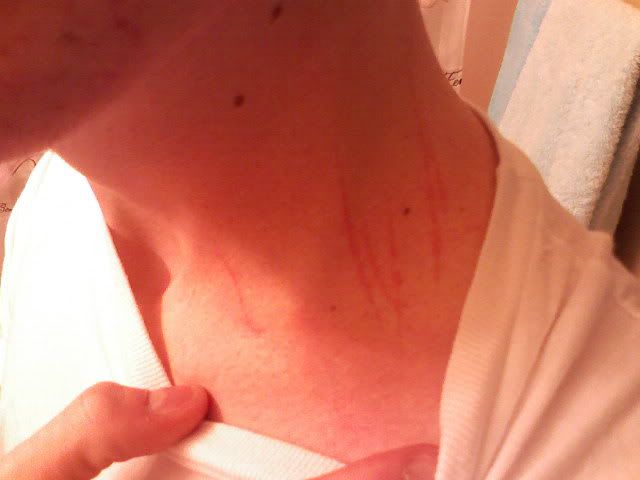 scratches.jpg