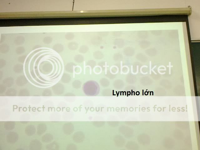 Hình ôn tập sinh LymphoLon2