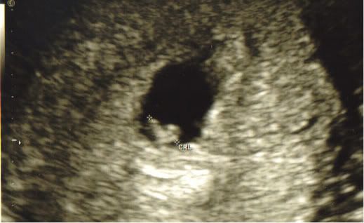 6 weeks, 6 days-my cute little blob, lol.
