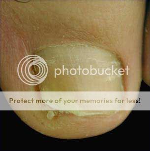 Image hosting by Photobucket