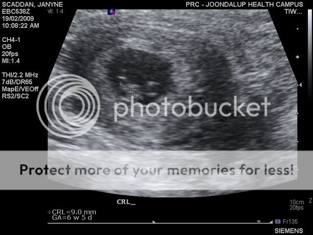 What did you 7 week ultrasound look like? - Pregnancy: Tips, Questions ...